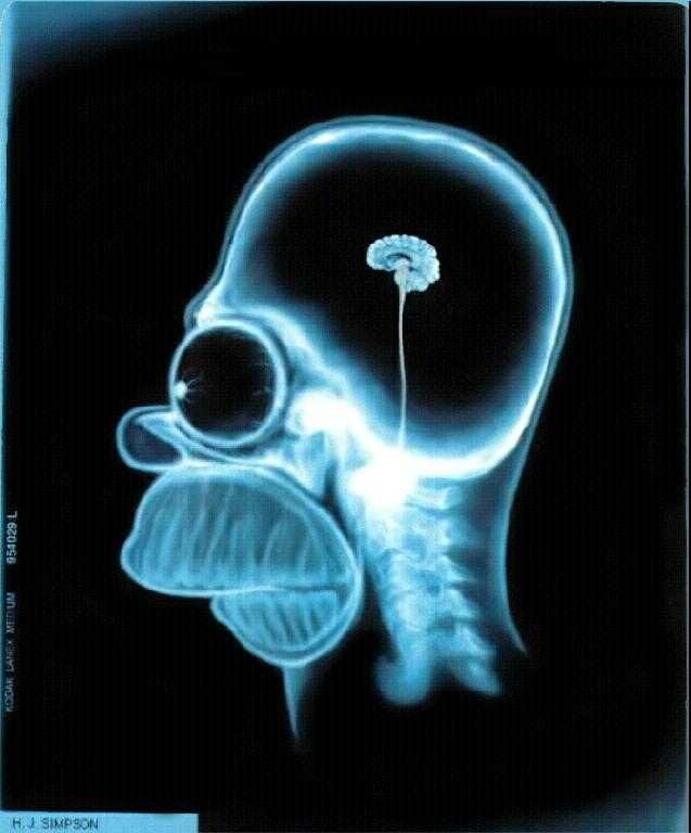 x-rays
