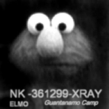 Elmo X-ray image